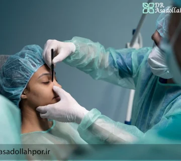 جراحی بینی در تهران