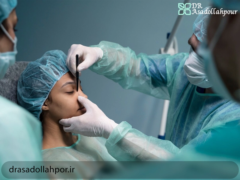 جراحی بینی در تهران