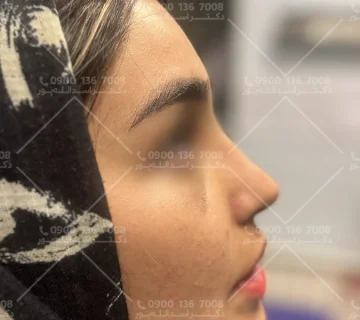 خطرات بیهوشی در جراحی بینی دکتر اسدالله پور