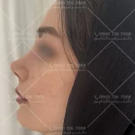 دکتر امیرحسین اسدالله پور جراح بینی قائمشهر