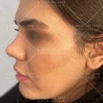 دکتر زیبایی اسدالله پور قائمشهر