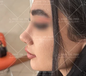 جراح بینی اسدالله پور