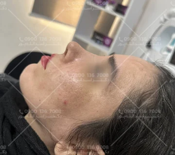 دکتر امیر اسدالله پور جراح بینی