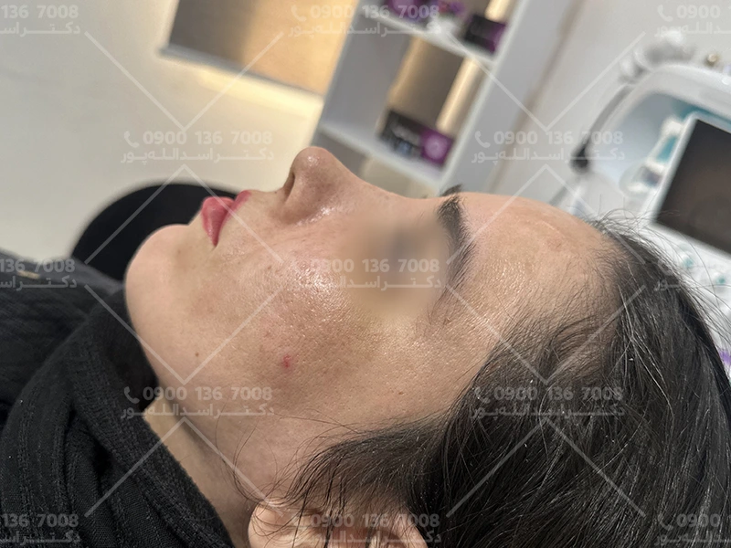 دکتر امیر اسدالله پور جراح بینی