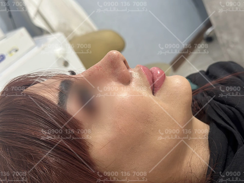علائم کمخونی